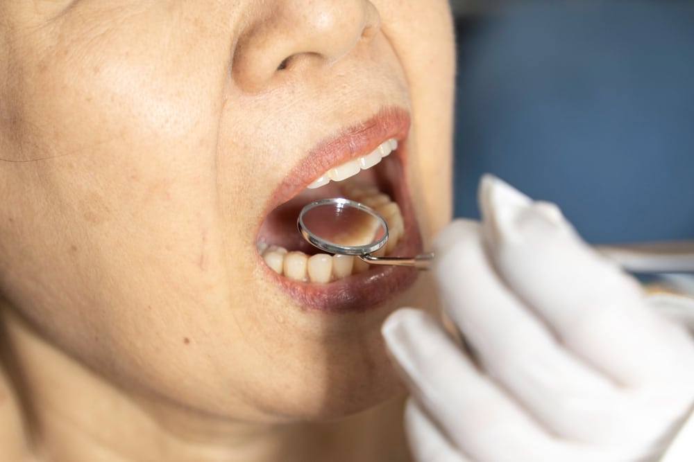 dental crowns near me